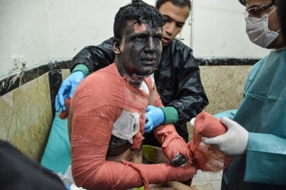 حوادث چهارشنبه سوری ۶ گلستانی را روانه بیمارستان کرد
